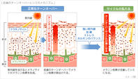 カイロプラクティックと「小顔」　vol.2